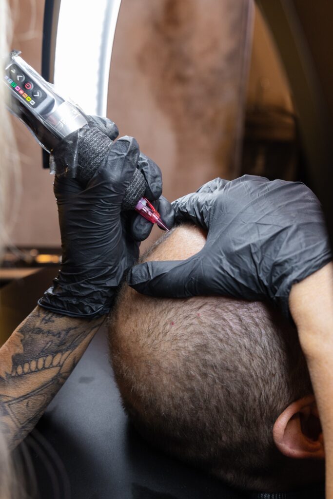 Scalp Service